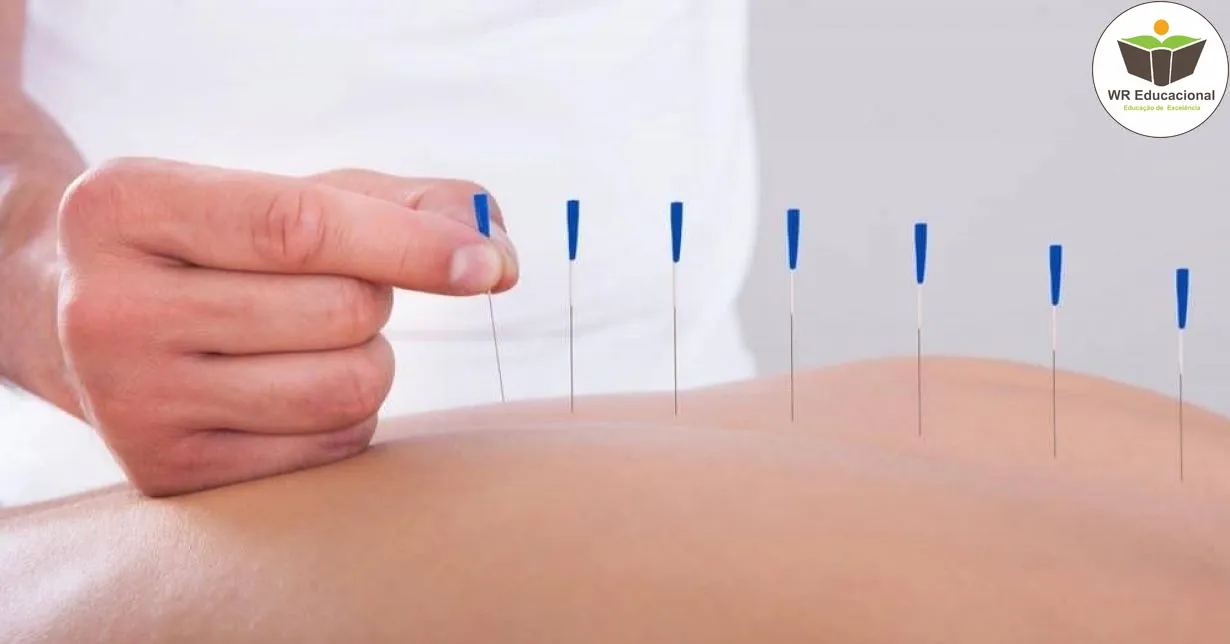 Curso de NOÇÕES BÁSICAS DA ACUPUNTURA CHINESA