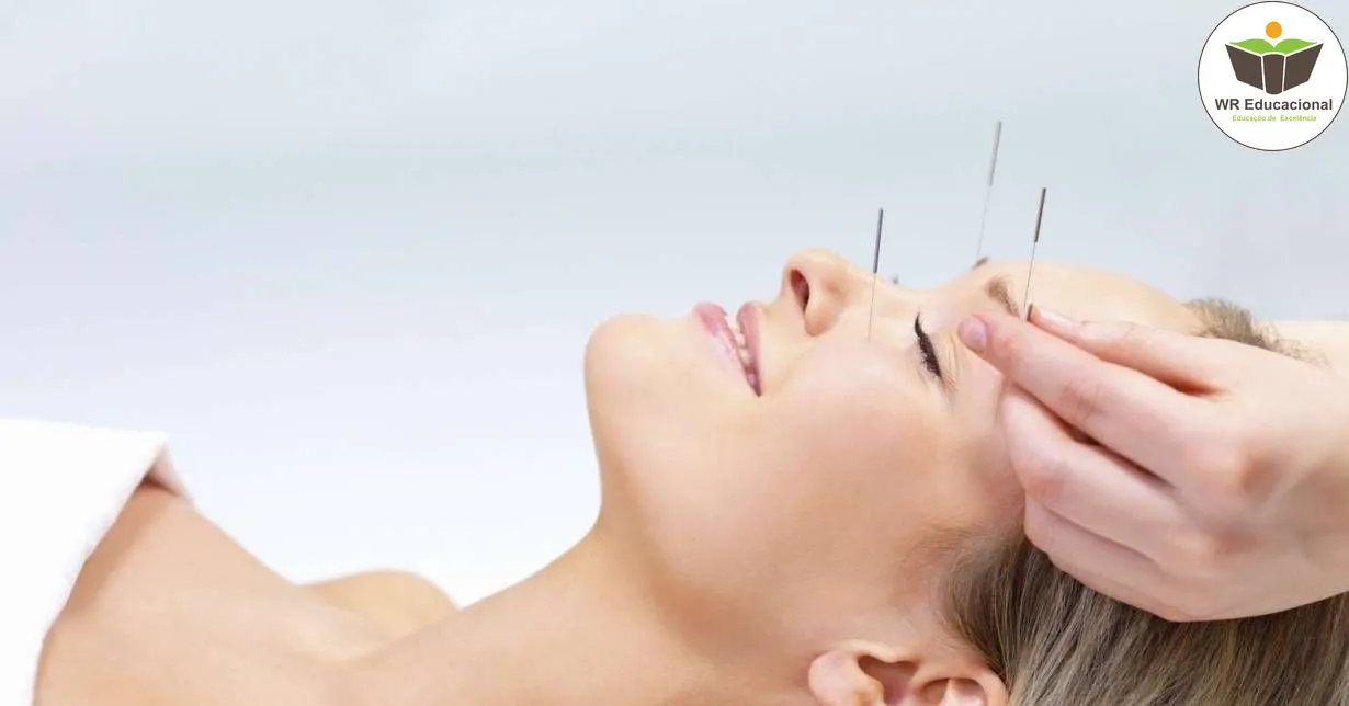 Curso de NOÇÕES BÁSICAS EM ACUPUNTURA