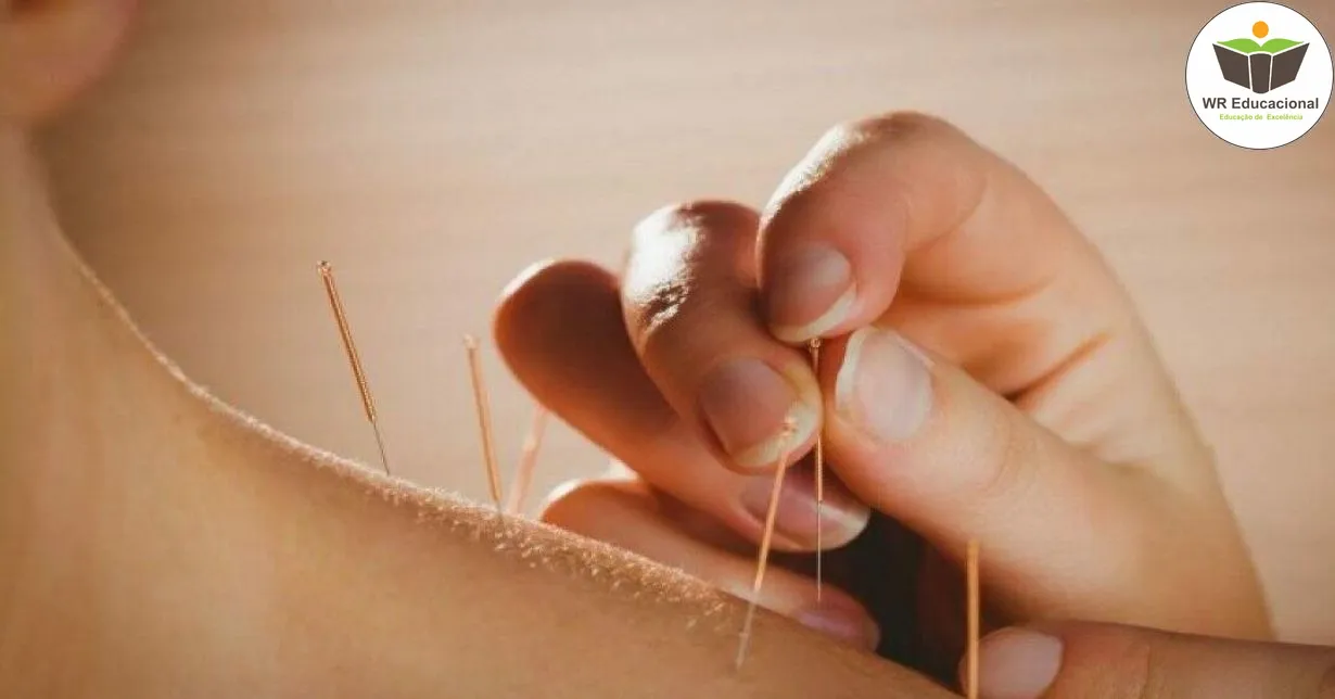 Curso de NOÇÕES BÁSICAS DA AURICULOTERAPIA NA REDUÇÃO DA ANSIEDADE