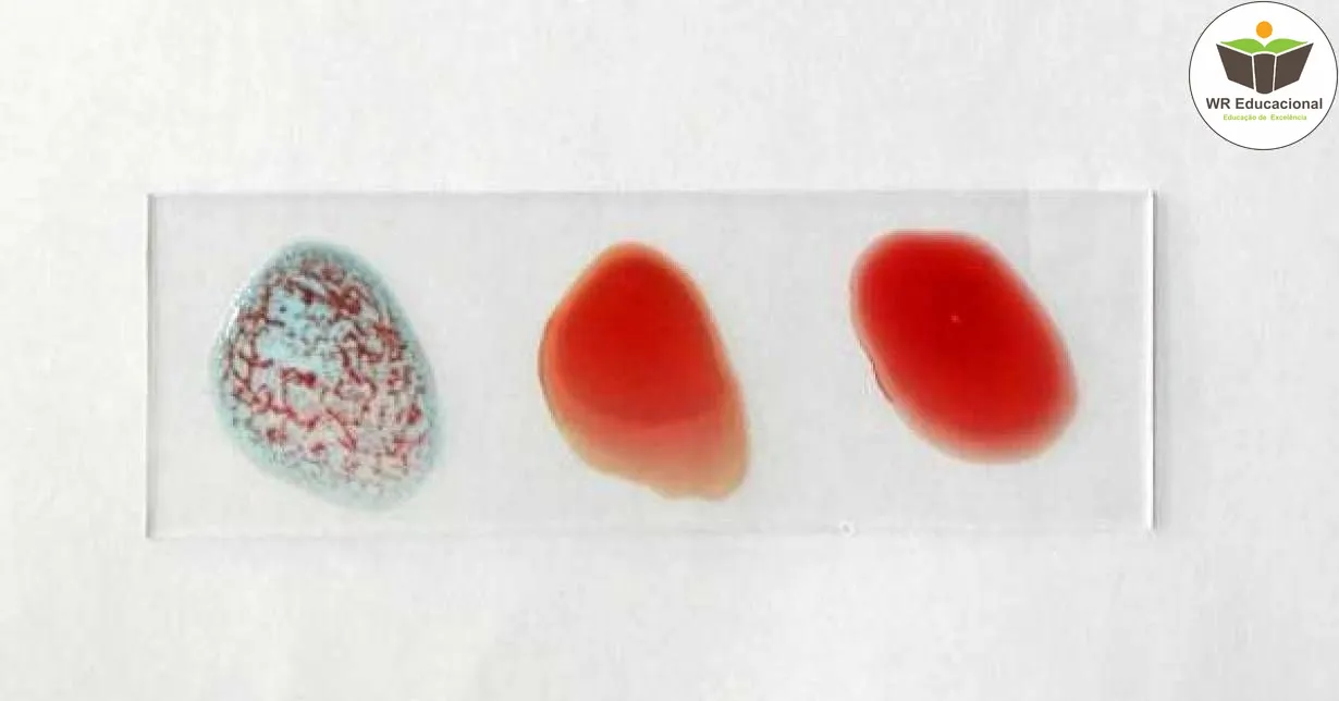 Curso de NOÇÕES BÁSICAS EM AUXILIAR DE IMUNOHEMATOLOGIA