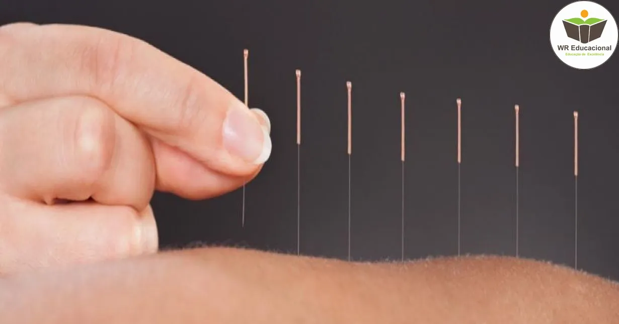 Curso de INTRODUÇÃO EM ACUPUNTURA