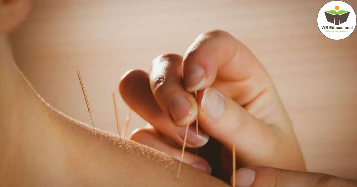 Curso de NOÇÕES BÁSICAS EM TÉCNICAS DE ACUPUNTURA