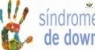 Curso de Síndrome de Down - O Olhar na Educação