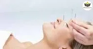 Curso de NOÇÕES BÁSICAS EM ACUPUNTURA