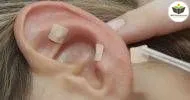Curso de INTRODUÇÃO EM AURICULOTERAPIA