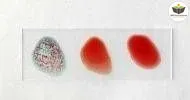 Curso de NOÇÕES BÁSICAS EM AUXILIAR DE IMUNOHEMATOLOGIA